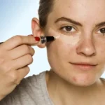 Wearing Makeup with Acne