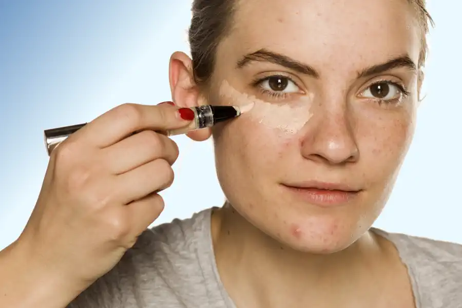 Wearing Makeup with Acne