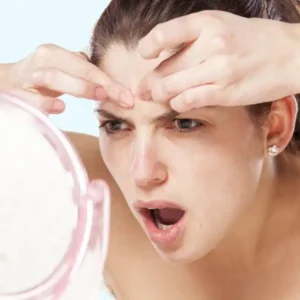 Girl Popping a Pimple