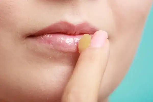 Applying Honey to Chapped Lips