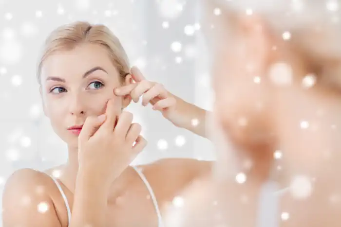 Woman with Winter Acne